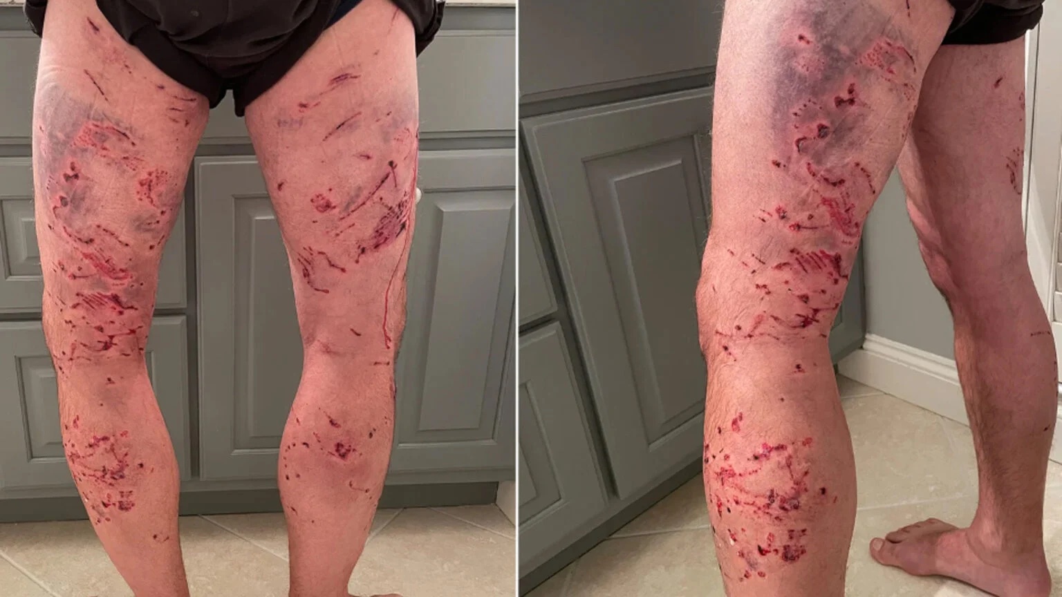 Georgia hunter attacked by dogs